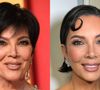 Kris Jenner chocou ao 'mudar de rosto' aos 69 anos após passar por um lifting facial que transformou sua aparência