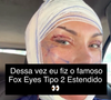 "Mas lembrando: o resultado final ainda NÃO apareceu, porque eu acabei de operar. Pós-operatório exige paciência, cuidado e acompanhamento", comentou Andressa Urach