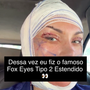 "Mas lembrando: o resultado final ainda NÃO apareceu, porque eu acabei de operar. Pós-operatório exige paciência, cuidado e acompanhamento", comentou Andressa Urach