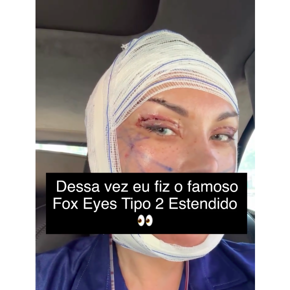 "Mas lembrando: o resultado final ainda NÃO apareceu, porque eu acabei de operar. Pós-operatório exige paciência, cuidado e acompanhamento", comentou Andressa Urach