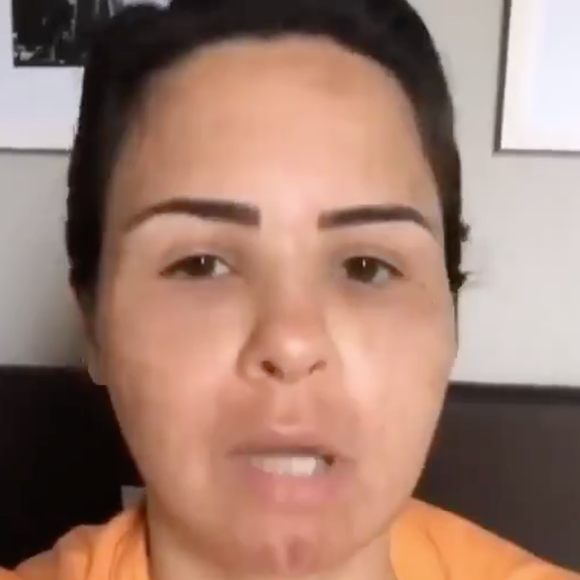 Na ocasião, Ana Paula Renault tinha acabado de realizar um procedimento estético no rosto e estava inchada