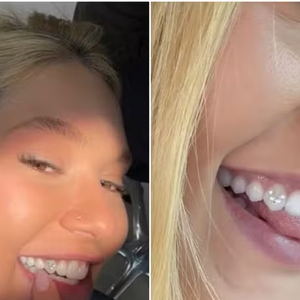 Virgínia Fonseca voltou a viralizar ao apostar no tooth gem em setembro de 2026 e exibiu uma joia formada por pequenos diamantes no dente, criando a letra 'V' em referência à inicial de seu nome e à homenagem a Vini Jr