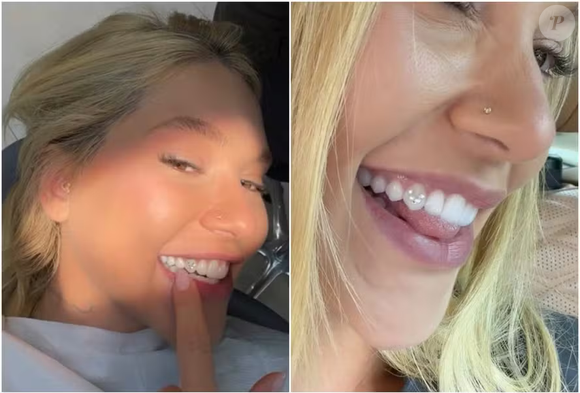 Virgínia Fonseca voltou a viralizar ao apostar no tooth gem em setembro de 2026 e exibiu uma joia formada por pequenos diamantes no dente, criando a letra 'V' em referência à inicial de seu nome e à homenagem a Vini Jr
