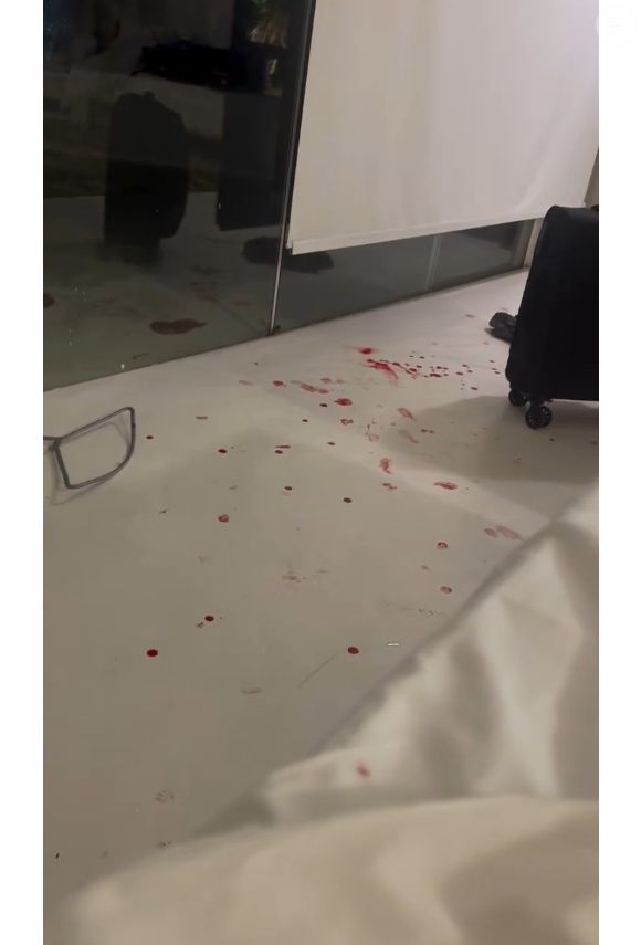 Ex de Dado Dolabella, Marcela Tomaszewski exibiu quarto com manchas de sangue após briga com o ator. Segundo ele, modelo se cortou sozinha com copo de vidro