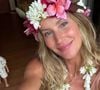 Gisele Bündchen relatou insegurança com ataques sobre a aparência, mas isso mudou aos 16 anos quando foi chamada para desfile, meses depois posou para a 'Vogue', sendo capa da edição da Inglaterra