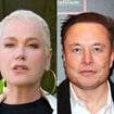 De Xuxa a Elon Musk: estes 20 famosos fizeram transplante capilar, deram 'adeus' à calvície e impactaram com antes e depois. Veja fotos!