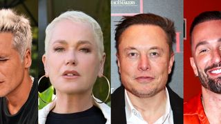 De Xuxa a Elon Musk: estes 20 famosos fizeram transplante capilar, deram 'adeus' à calvície e impactaram com antes e depois. Veja fotos!