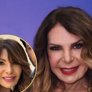 O que Elba Ramalho fez no rosto? Especialista desvenda procedimentos para o rejuvenescimento da cantora aos 74 anos