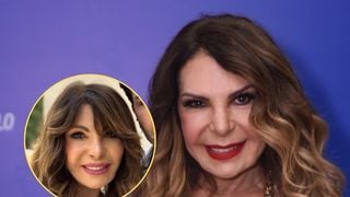 O que Elba Ramalho fez no rosto? Especialista desvenda segredos do rejuvenescimento da cantora aos 74 anos com procedimentos: 'Mudanças expressivas'