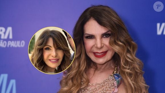 O que Elba Ramalho fez no rosto? Especialista desvenda procedimentos para o rejuvenescimento da cantora aos 74 anos