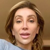 Maya Massafera antes e depois: após novo procedimento no rosto, influenciadora revela valor gasto com cirurgias - é maior que o prêmio do 'BBB'!