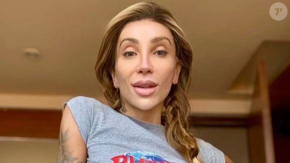 Maya Massafera revela valor gasto com procedimentos estéticos após a transição de gênero e valor impressiona