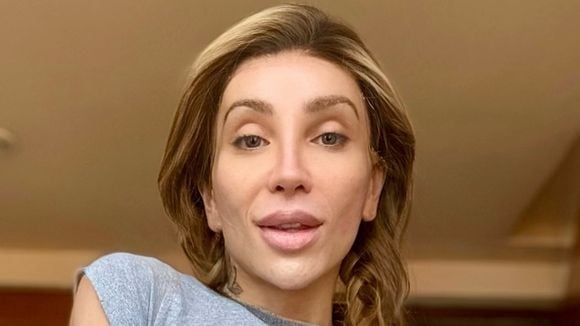 Maya Massafera antes e depois: após novo procedimento no rosto, influenciadora revela valor gasto com cirurgias - é maior que o prêmio do 'BBB'!