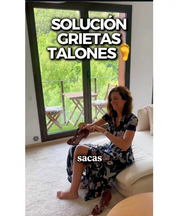Ana Molina alerta que sandálias abertas e chinelos podem agravar rachaduras nos pés