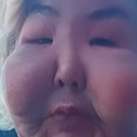 Quem é a Juju do Pix? Influenciadora que viralizou por injetar óleo mineral no rosto rebate críticas: 'Não tenho culpa de ter...'