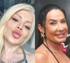 Harmonização facial de famosos: antes e depois de 20 celebridades dividem opiniões com resultados