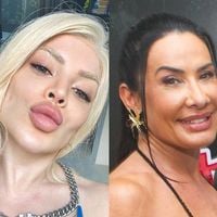 Harmonização facial antes e depois: de Gkay a Scheila Carvalho, estes 20 famosos mudaram 'da água para o vinho' com o procedimento estético e dividiram opiniões