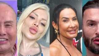 Harmonização facial antes e depois: de Gkay a Scheila Carvalho, estes 20 famosos mudaram 'da água para o vinho' com o procedimento estético e dividiram opiniões