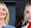Cameron Diaz escolheu o botox como estratégia para prevenir o envelhecimento e 'pés de galinha'