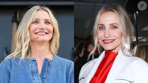 Cameron Diaz escolheu o botox como estratégia para prevenir o envelhecimento e 'pés de galinha'