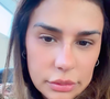 Simone Mendes voltou a comentar sua mudança nos stories do Instagram e pediu paciência ao público
