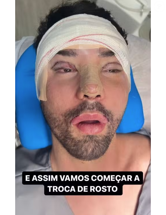 Rico Melquiades ficou assim após as últimas cirurgias, feitas há poucos meses