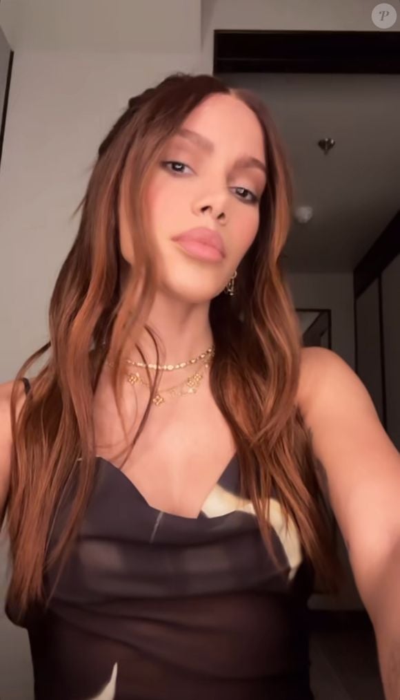 Anitta passou por um lifting facial, segundo a colunista Fábia Oliveira, do portal Metrópoles