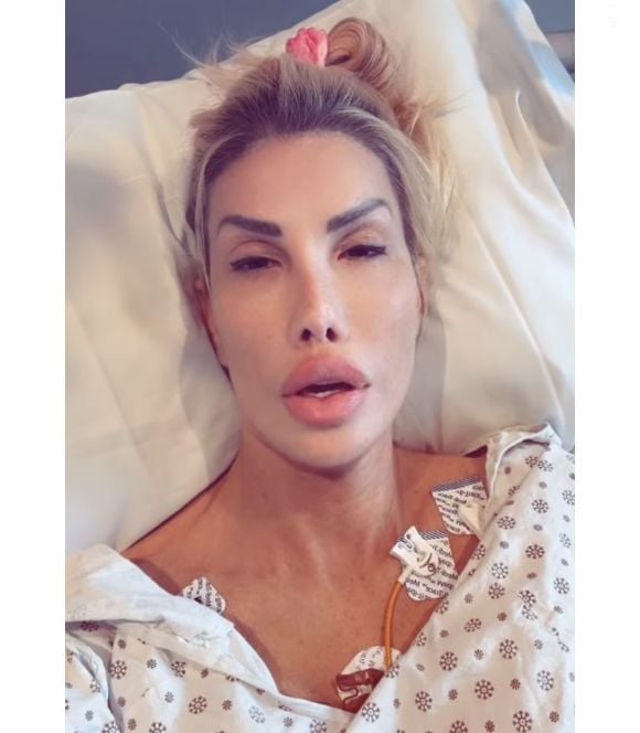 Ex-reality, Nikki Exotika passou por cirurgia de 7 horas e colocou 4 pontes de safena