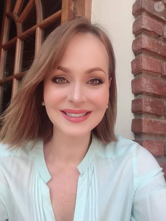 Gaby Spanic costuma aplicar botox em áreas estratégicas do seu rosto