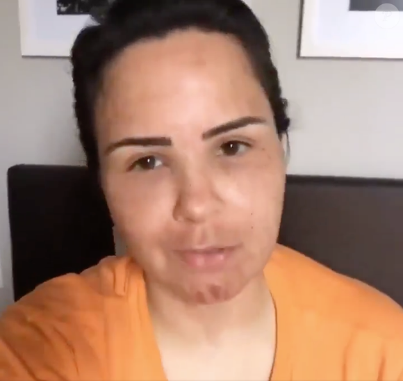 Internautas resgataram um vídeo antigo de Ana Paula Renault onde ela está morena e com a feição irreconhecível