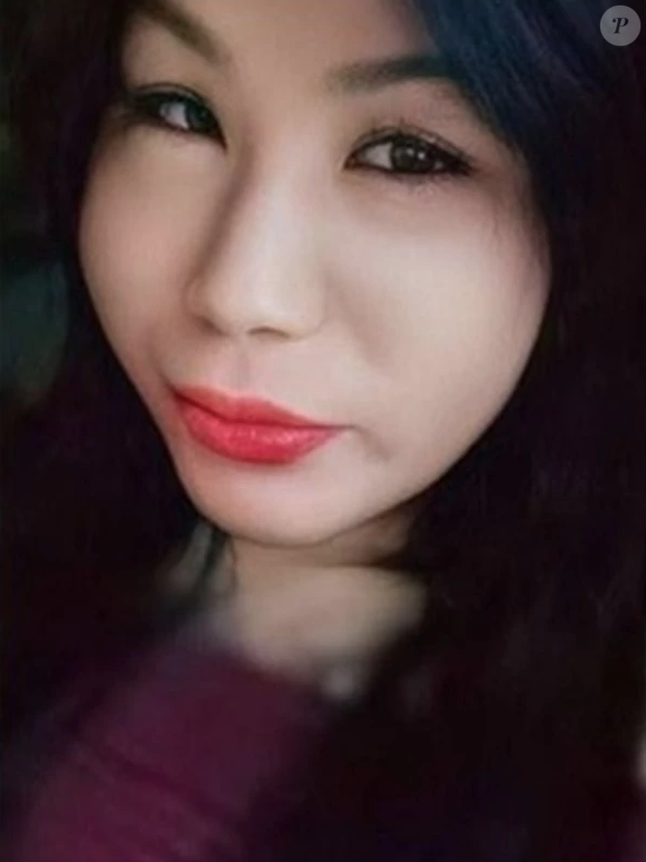 O objetivo de Juju Oliveira era aplicar silicone industrial em seu rosto, mas foi enganada na clínica