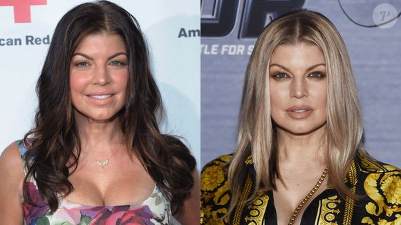 Lembra dela? Fergie tem apostado no botox nos últimos anos e garantiu um visual bastante diferente