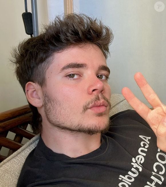 João Lucas também fez uma rinoplastia que transformou seu rosto