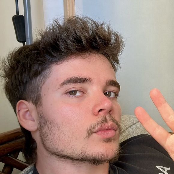 João Lucas também fez uma rinoplastia que transformou seu rosto