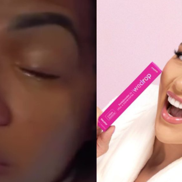 Entrevista | Vítima de produto da WePink, cabeleireira desmente versão da marca e relata momentos de tensão após passar dias sem enxergar: ‘Traumatizada’