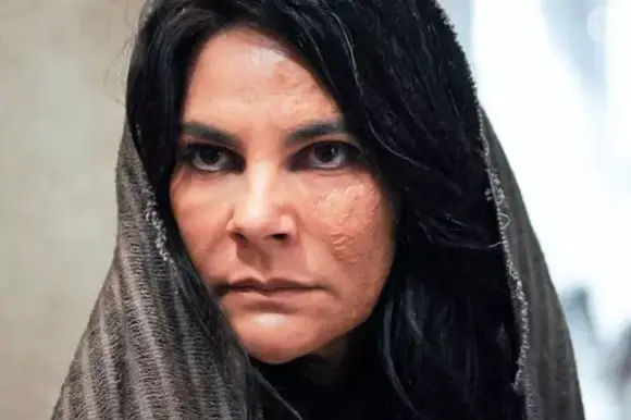 Cibele Larrama teve parte dos ombros e dos cabelos queimados após mexer com polvora em cena de Rei Davi