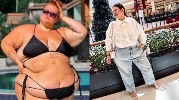 Antes e depois de Thais Carla: influenciadora eliminou mais de 70 kg após uma cirurgia bariátrica