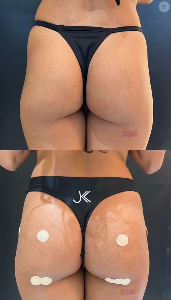 Segundo informações da equipe que atendeu Bella, a atriz é paciente do espaço há mais de um ano e, desta vez, optou pelo Protocolo Glúteo, tratamento voltado para aprimorar o contorno corporal de forma natural.