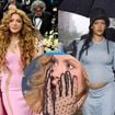 'Shakira boca de sacola': cantora comete GAFE e entrega nova gravidez de Rihanna no MET Gala 2025