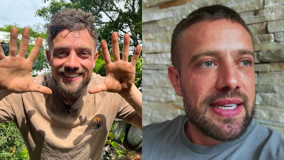 Antes e depois de Rafael Cardoso: um dos principais galãs recentes da Globo mudou muito sua aparência com harmonizações nos últimos anos