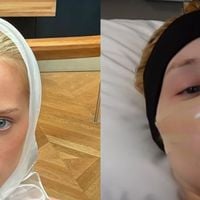 Antes e depois de Malu Borges: resultado DEFINITIVO da rinoplastia da influenciadora é impressionante; veja fotos!