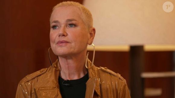 Fãs defendem Xuxa após críticas à aparência de seu braço