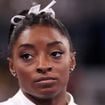 'Coçava tanto e usava um pente que sangrava': aos 29 anos, Simone Biles revela diagnóstico de doença crônica no couro cabeludo; médica alerta sobre relação com estresse
