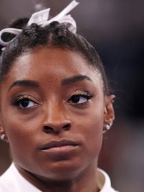 'Coçava tanto e usava um pente que sangrava': aos 29 anos, Simone Biles revela diagnóstico de doença crônica no couro cabeludo; médica alerta sobre relação com estresse
