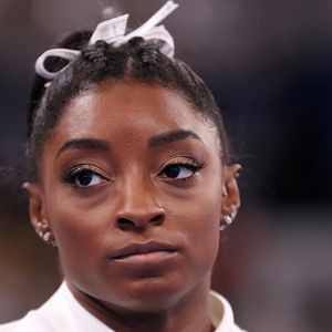 Aos 29 anos, Simone Biles revela diagnóstico de doença crônica no couro cabeludo; médicas alertam sobre relação com estresse: 'Coçava tanto e usava um pente que sangrava'