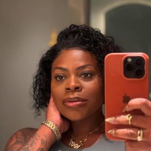 Após eliminar mais de 80 quilos com cirurgia bariátrica, reeducação alimentar e exercícios físicos, Jojo Todynho anunciou que passará por uma nova intervenção estética