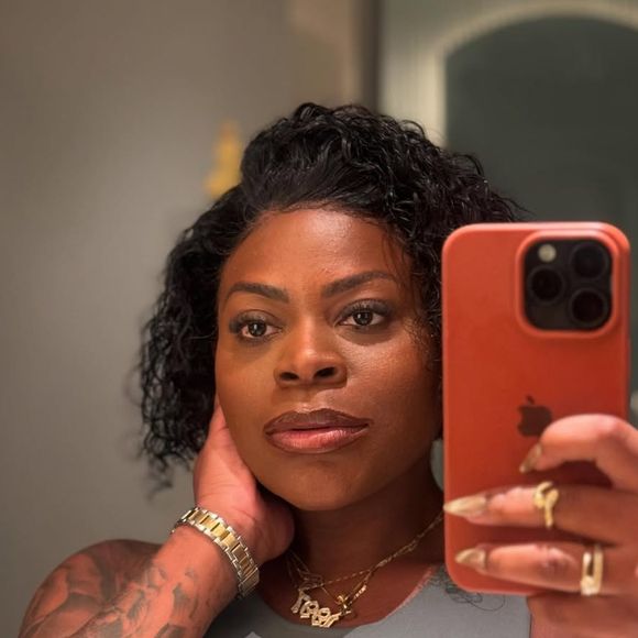 Após eliminar mais de 80 quilos com cirurgia bariátrica, reeducação alimentar e exercícios físicos, Jojo Todynho anunciou que passará por uma nova intervenção estética