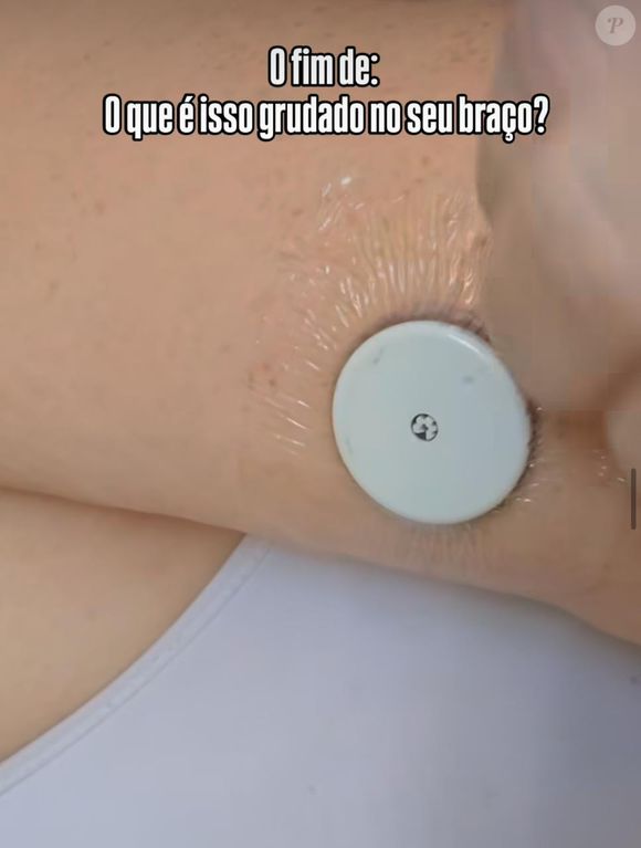 A babá de Léo, Luciene Melo, e o menino, foram diagnosticados com diabetes, e já apareceu usando um sensor de glicose.