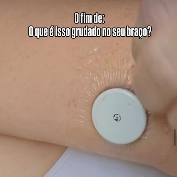 A babá de Léo, Luciene Melo, e o menino, foram diagnosticados com diabetes, e já apareceu usando um sensor de glicose.