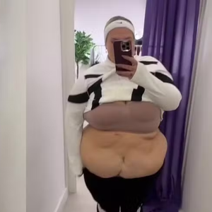 Thais Carla exibe corpo após perder mais de 50 kg e reclama do excesso de pele na barriga: 'Estou parecendo um sorvete'